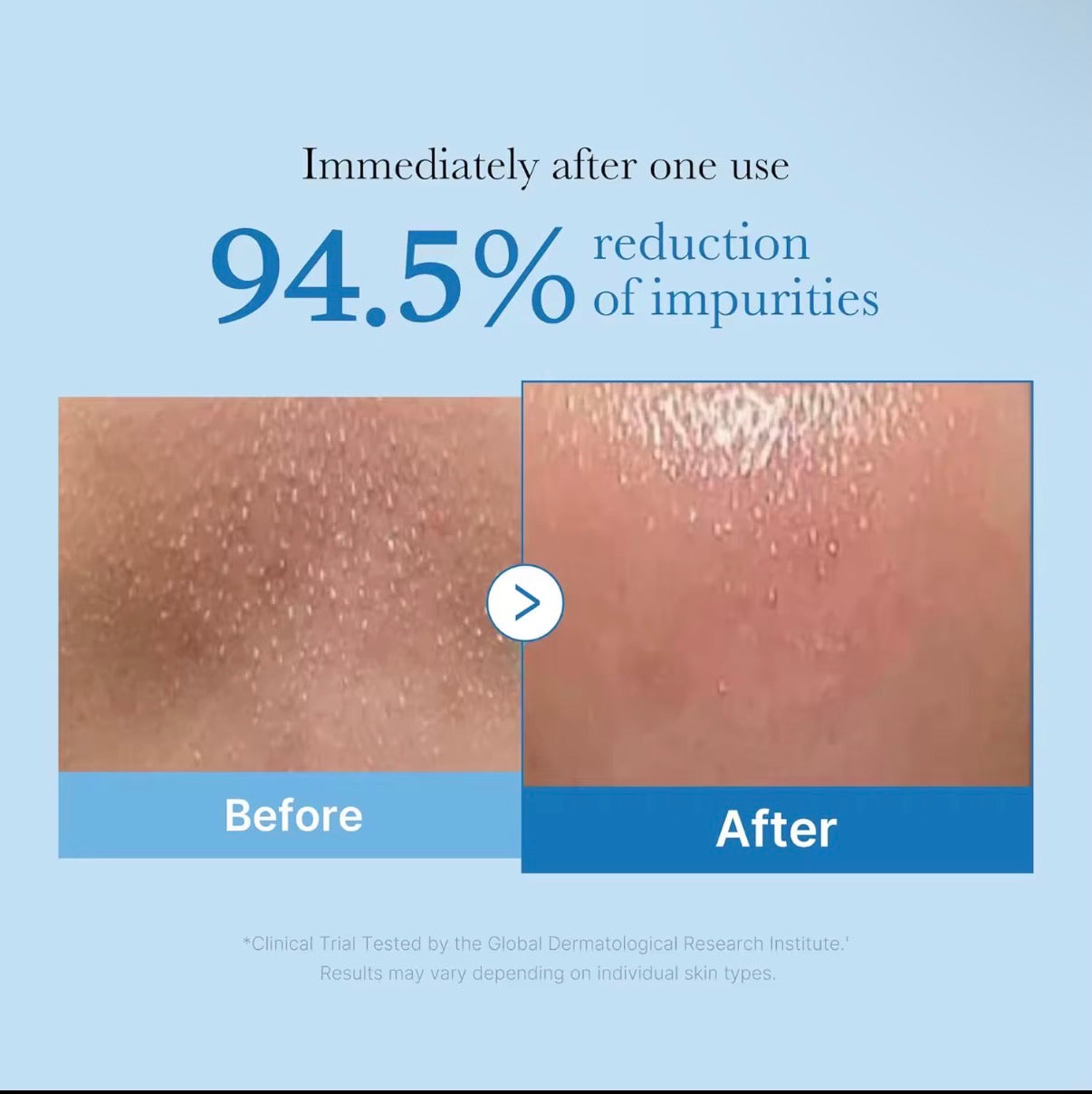 Elarys Zero Clean Oil